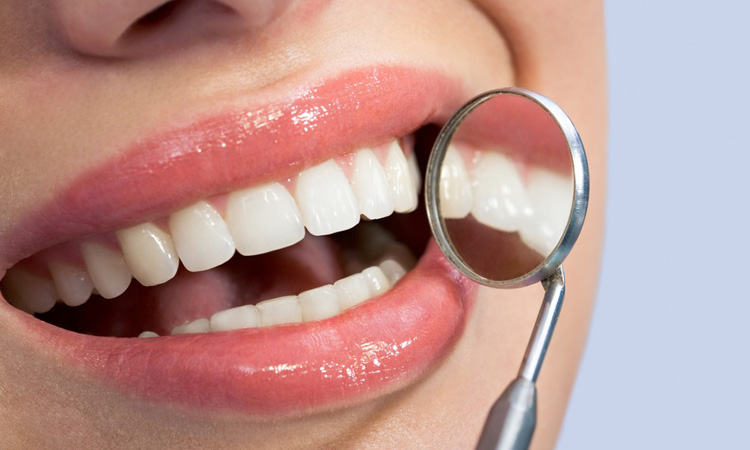 أنواع علاجات الأسنان للعناية بصحة فمك