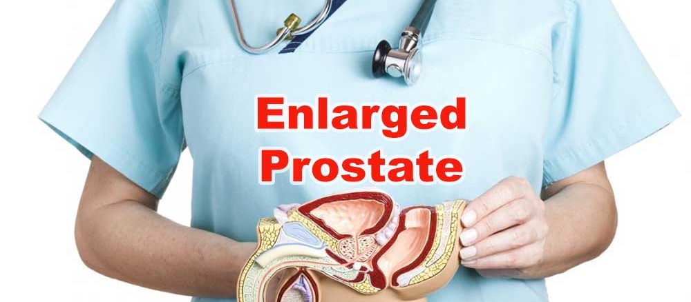 Prostate Enlargement treatment- Is it useful?