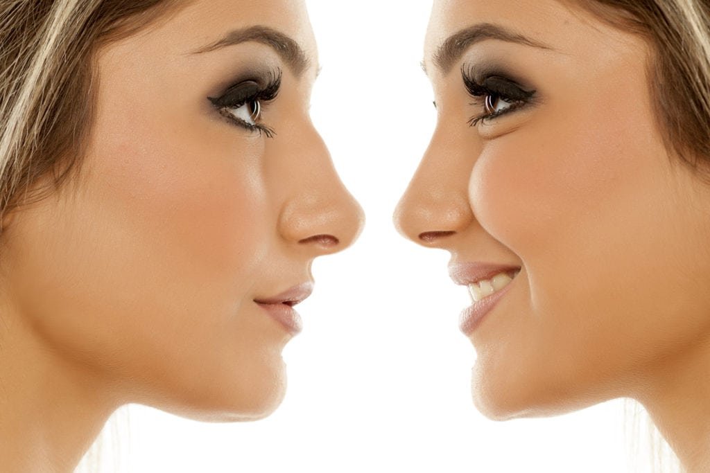 Advantages and disadvantages of getting a nose job in istanbul